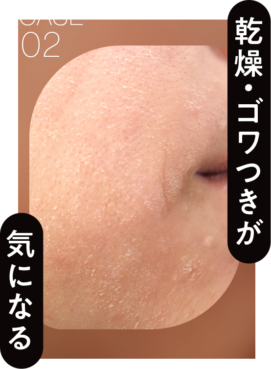 乾燥・ゴワつきが気になる