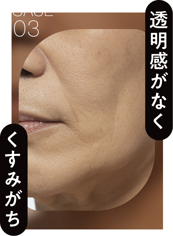 透明感がなくくすみがち